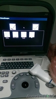 УЗИ системы из Израиля - Изображение #2, Объявление #1483236